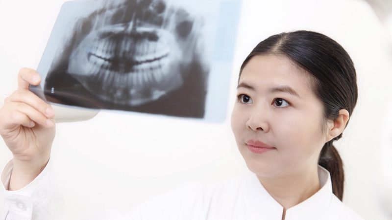 牙齿缝隙隐形矫正步骤详解